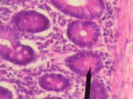 Human Paneth cells